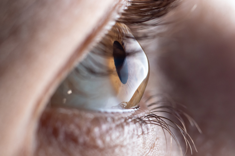 Cornea Specialists Seattle | Cornea Diseases Seattle, WA | EANW